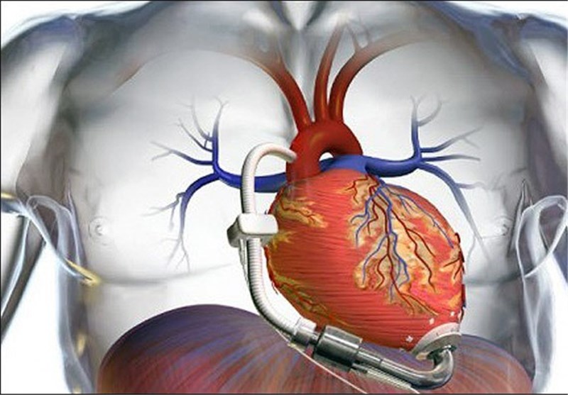 المادة التي تحميك من أمراض القلب والسرطان 2019-12-2822:59:00.290273-cardieu