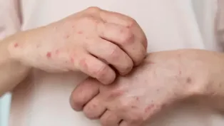 الصورة : ح.م